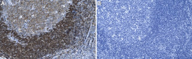 Anti-BAFF-R/CD268 Antibody, clone 11C1