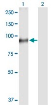 Anti-TGM1 antibody produced in rabbit purified immunoglobulin, buffered aqueous solution