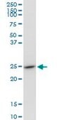 Anti-GSTO1 antibody produced in mouse purified immunoglobulin, buffered aqueous solution