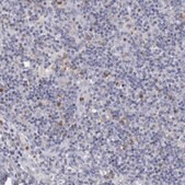 Anti-FGR antibody produced in rabbit Prestige Antibodies&#174; Powered by Atlas Antibodies, affinity isolated antibody, buffered aqueous glycerol solution