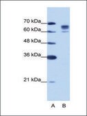 Anti-DDX17 antibody produced in rabbit IgG fraction of antiserum