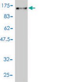 Monoclonal Anti-DNAI1 antibody produced in mouse clone 2D10-2A5, purified immunoglobulin, buffered aqueous solution