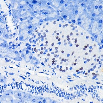 Anti-PAX6 antibody produced in rabbit