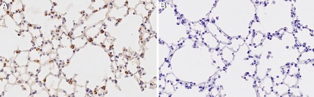 Anti-Prosurfactant Protein C (proSP-C) Antibody serum, Chemicon&#174;