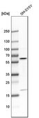 Anti-AKT3 antibody produced in rabbit Prestige Antibodies&#174; Powered by Atlas Antibodies, affinity isolated antibody, buffered aqueous glycerol solution