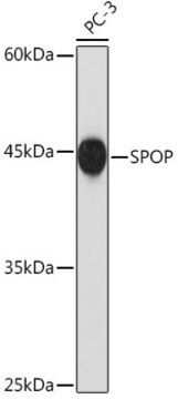 Anti-SPOP Antibody, clone 2N8L8, Rabbit Monoclonal