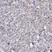 Anti-ERBB2 antibody produced in rabbit Ab1, Prestige Antibodies&#174; Powered by Atlas Antibodies, affinity isolated antibody, buffered aqueous glycerol solution