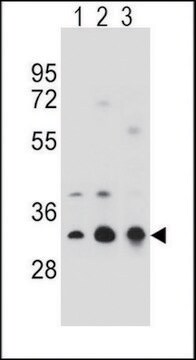 ANTI-TPM4 (N-TERM) antibody produced in rabbit IgG fraction of antiserum, buffered aqueous solution