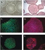 PluriSTEM&#174; Human ES/iPS Cell Medium Defined small molecule based serum-free medium that enables feeder-free culture of human ES/iPS cells and allows for media exchanges every other day without compromising the morphology or long term functionality of human pluripotent stem cells.