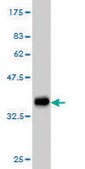 Monoclonal Anti-FGR antibody produced in mouse clone 3G10, purified immunoglobulin, buffered aqueous solution