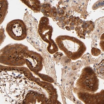 Anti-LAMB1 antibody produced in rabbit Prestige Antibodies&#174; Powered by Atlas Antibodies, affinity isolated antibody, buffered aqueous glycerol solution