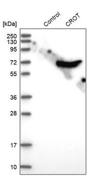 Anti-CROT antibody produced in rabbit Prestige Antibodies&#174; Powered by Atlas Antibodies, affinity isolated antibody, buffered aqueous glycerol solution, Ab1