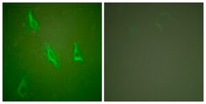 Anti-CASP10 antibody produced in rabbit affinity isolated antibody