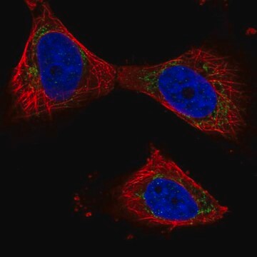 Anti-PPP3CB antibody produced in rabbit Prestige Antibodies&#174; Powered by Atlas Antibodies, affinity isolated antibody