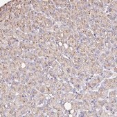 Anti-CAT antibody produced in rabbit Prestige Antibodies&#174; Powered by Atlas Antibodies, affinity isolated antibody, buffered aqueous glycerol solution