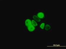 Monoclonal Anti-PGR antibody produced in mouse clone 5D10, purified immunoglobulin, buffered aqueous solution