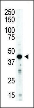 ANTI-AURORA-B (ARK/STK12) (CENTER) antibody produced in rabbit IgG fraction of antiserum, buffered aqueous solution