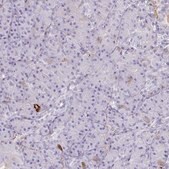 Anti-F2 antibody produced in rabbit Prestige Antibodies&#174; Powered by Atlas Antibodies, affinity isolated antibody, buffered aqueous glycerol solution