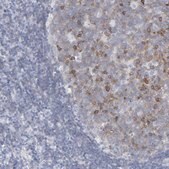 Anti-P2RY8 antibody produced in rabbit Prestige Antibodies&#174; Powered by Atlas Antibodies, affinity isolated antibody, buffered aqueous glycerol solution