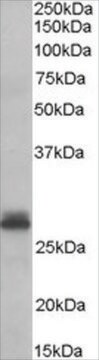 Anti-Tafazzin antibody produced in goat affinity isolated antibody, buffered aqueous solution