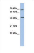 Anti-RARG antibody produced in rabbit affinity isolated antibody