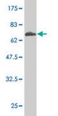 Monoclonal Anti-HSD3B1 antibody produced in mouse clone 3C11-D4, purified immunoglobulin, buffered aqueous solution