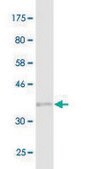 Monoclonal Anti-PARP1, (N-terminal) antibody produced in mouse clone 2C7, purified immunoglobulin, buffered aqueous solution