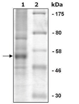 PHF8 human recombinant, expressed in baculovirus infected Sf9 cells, &#8805;80% (SDS-PAGE)