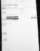 Anti-CDK7 antibody produced in rabbit Prestige Antibodies&#174; Powered by Atlas Antibodies, affinity isolated antibody, buffered aqueous glycerol solution