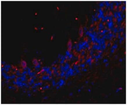 Anti-TMEM106B Antibody, clone TME-N 6F2 clone TME-N 6F2, from rat