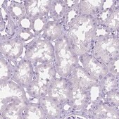 Anti-MMP9 antibody produced in rabbit affinity isolated antibody, buffered aqueous glycerol solution