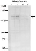 Anti-phospho BRD4 (Ser492) from rabbit