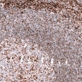 Anti-TSPO antibody produced in mouse Prestige Antibodies&#174; Powered by Atlas Antibodies, clone CL13359, purified by using Protein A, buffered aqueous glycerol solution