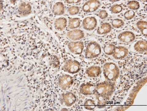 Anti-ETHE1 antibody produced in mouse IgG fraction of antiserum, buffered aqueous solution