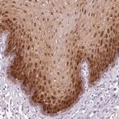Anti-FABP5 antibody produced in rabbit Prestige Antibodies&#174; Powered by Atlas Antibodies, affinity isolated antibody, buffered aqueous glycerol solution