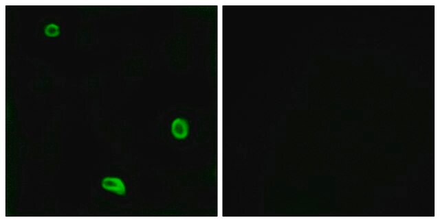 Anti-PAR4 antibody produced in rabbit affinity isolated antibody