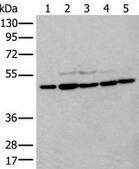 Anti-TUBB affinity isolated antibody