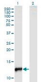 Monoclonal Anti-CYP24A1, (C-terminal) antibody produced in mouse clone 1E1, purified immunoglobulin, buffered aqueous solution