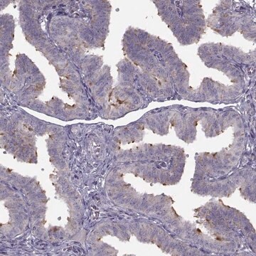 Anti-C9orf116 antibody produced in rabbit Prestige Antibodies&#174; Powered by Atlas Antibodies, affinity isolated antibody