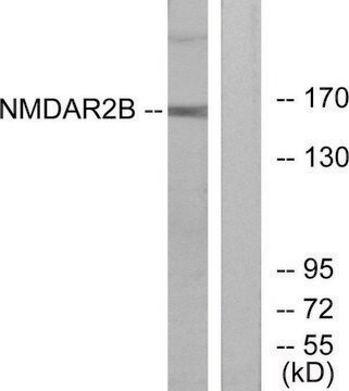 Anti-NMDAR2B antibody produced in rabbit affinity isolated antibody