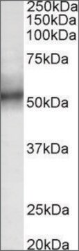 Anti-TRIM11 antibody produced in goat affinity isolated antibody, buffered aqueous solution