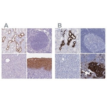 Anti-RHCG antibody produced in rabbit Prestige Antibodies&#174; Powered by Atlas Antibodies, affinity isolated antibody, buffered aqueous glycerol solution