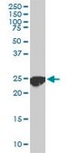 Monoclonal Anti-CLPP antibody produced in mouse clone 300, purified immunoglobulin, buffered aqueous solution