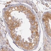 Anti-IKBKB antibody produced in rabbit Prestige Antibodies&#174; Powered by Atlas Antibodies, affinity isolated antibody, buffered aqueous glycerol solution