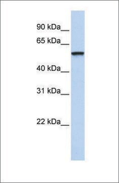 Anti-TRIM4 antibody produced in rabbit affinity isolated antibody