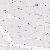 Anti-VSX2 antibody produced in rabbit Prestige Antibodies&#174; Powered by Atlas Antibodies, affinity isolated antibody, buffered aqueous glycerol solution