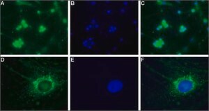 Anti-Calcium Channel CaV3.2 (&#945;1H) antibody produced in rabbit affinity isolated antibody, lyophilized powder