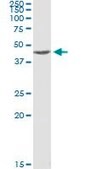 ANTI-MAPKAPK2 antibody produced in mouse clone 1F9, purified immunoglobulin, buffered aqueous solution