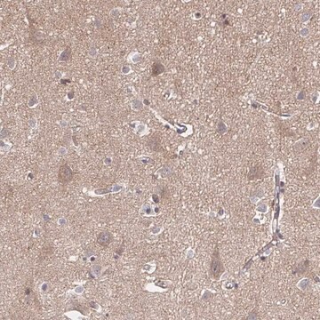 Anti-APBB1 antibody produced in rabbit Prestige Antibodies&#174; Powered by Atlas Antibodies, affinity isolated antibody, buffered aqueous glycerol solution