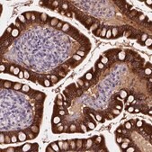 Anti-CES2 antibody produced in rabbit Prestige Antibodies&#174; Powered by Atlas Antibodies, affinity isolated antibody, buffered aqueous glycerol solution
